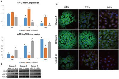 Effects of Different Ligands in the Notch Signaling Pathway on the Proliferation and Transdifferentiation of Primary Type II Alveolar Epithelial Cells